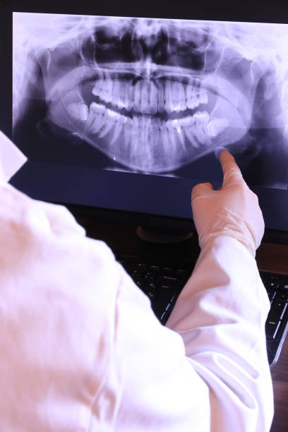 Best Emergency Wisdom Teeth Removal in Conover, NC