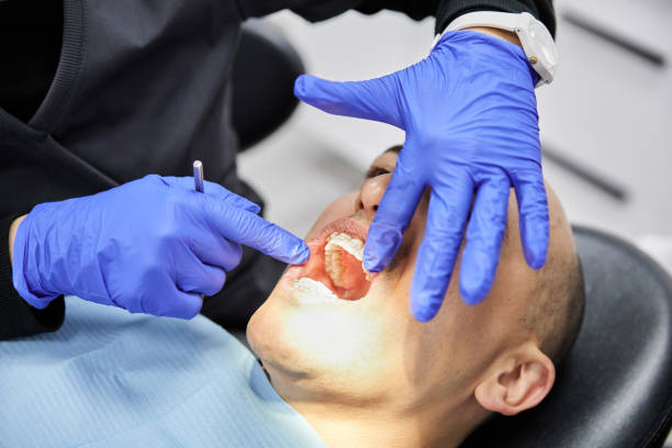 Best Emergency Dental Care for Broken or Chipped Teeth in Conover, NC